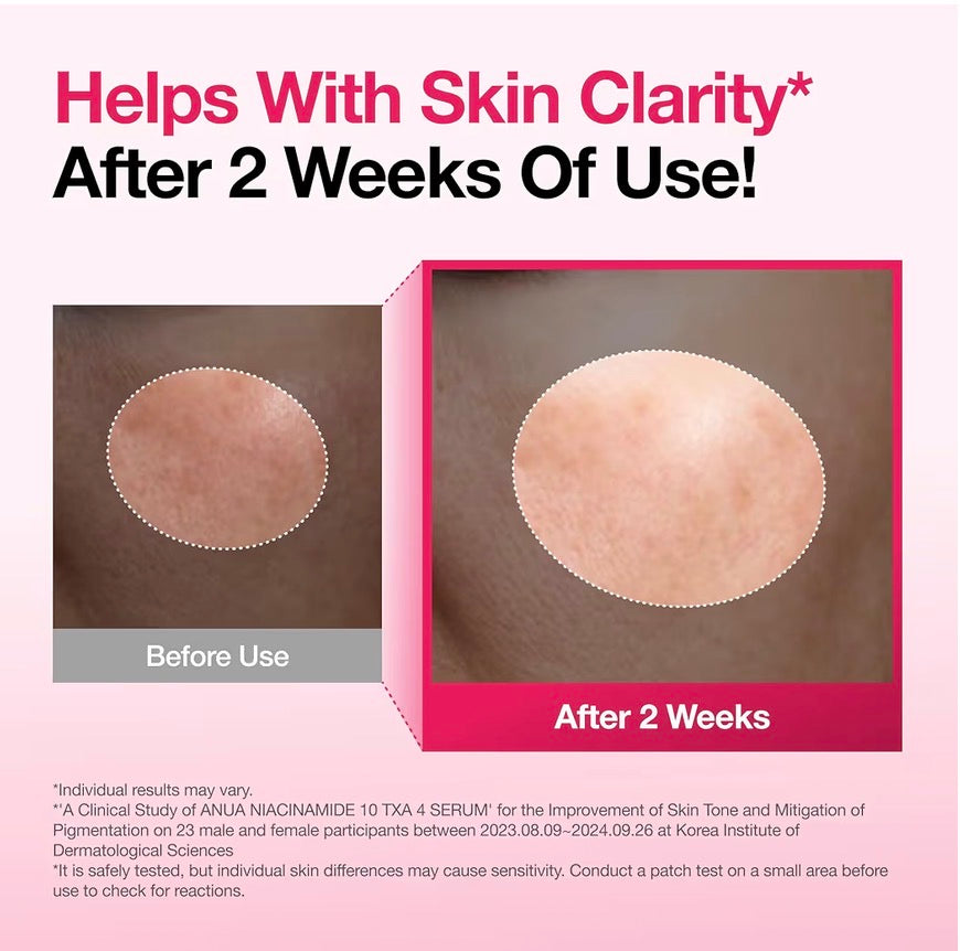 Anua Niacinamide 10% + TXA 4% Serum